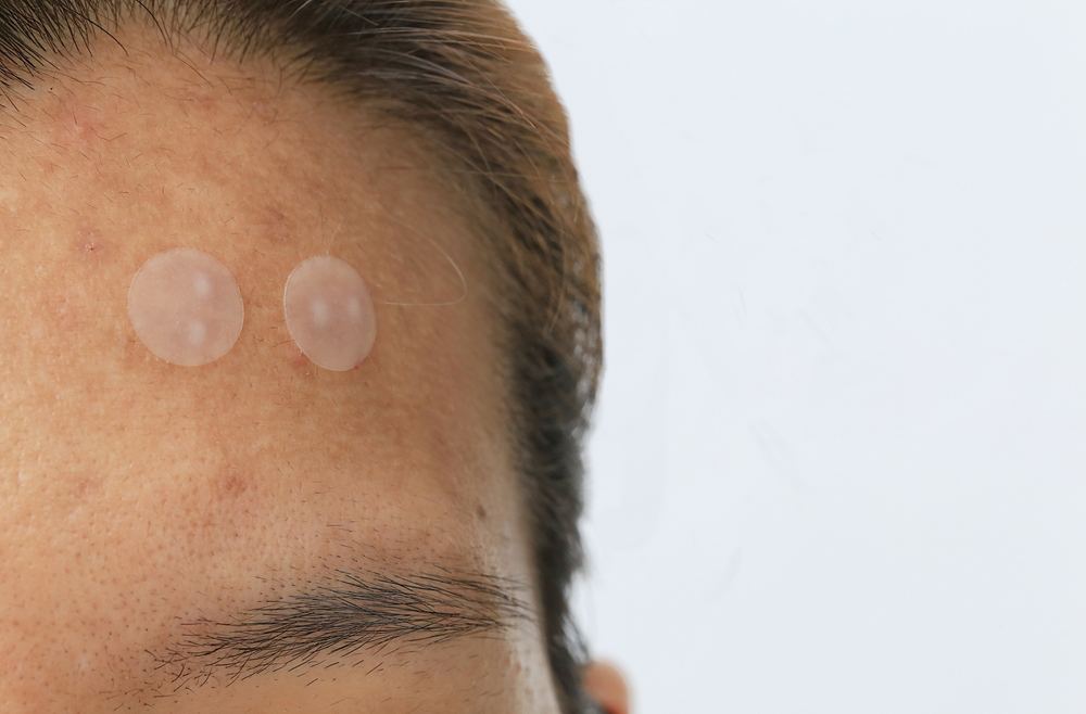 Understanding the White Stuff on Pimple Patches: A Comprehensive Analysis