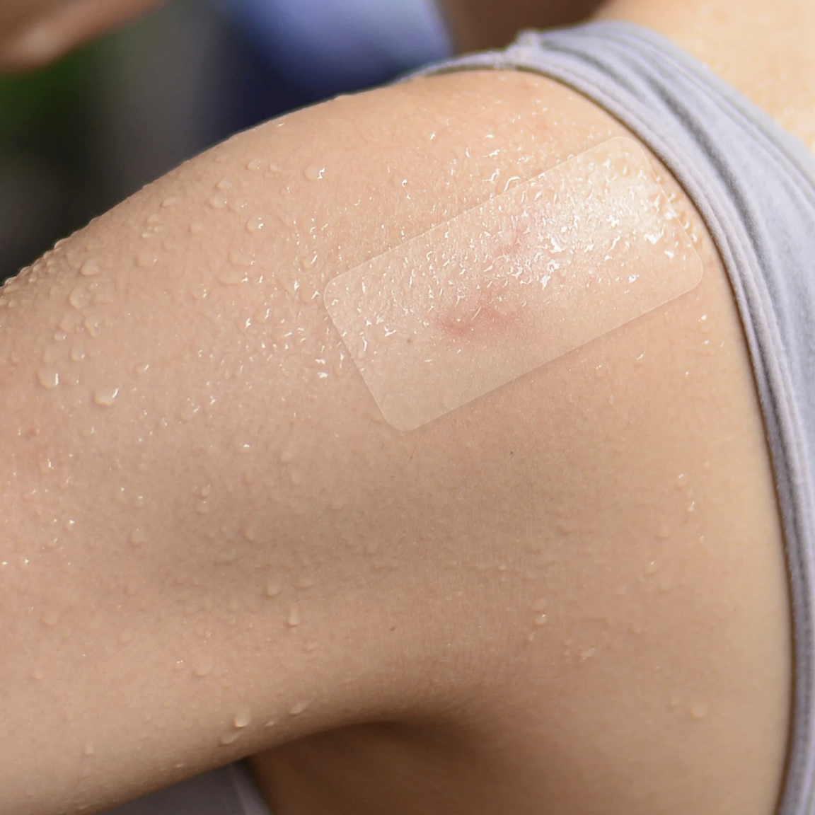 An Avarelle ZITOUT FIT 16CT pimple patch applied on a slightly moistened arm.