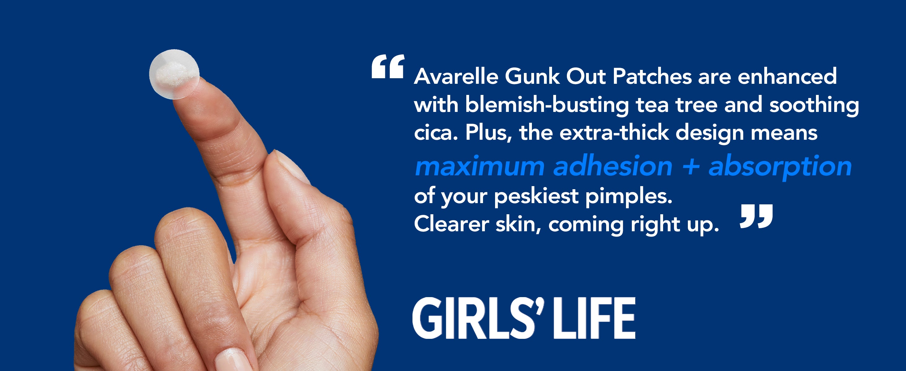 showcasing an Avarelle GUNK OUT: Spot Tech 100CT pimple patch on a finger with benefits listed for clearer skin. by Girls' Life quoting "Avarelle Gunk Out Patches are enhanced with blemish-busting tea tree and soothing cica. Plus, the extra-thick design means maximum adhesion + absorption of your peskiest pimples. Clearer skin, coming right up."