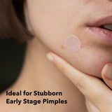 A person with an Avarelle Multi-Dart Patch on their cheek to treat an early stage pimple.