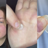A video of multiple people holding and showing amazing results for Avarelle acne patch on their fingertip, with a close-up view of the GUNK OUT: Spot Tech 100CT patch next to a woman