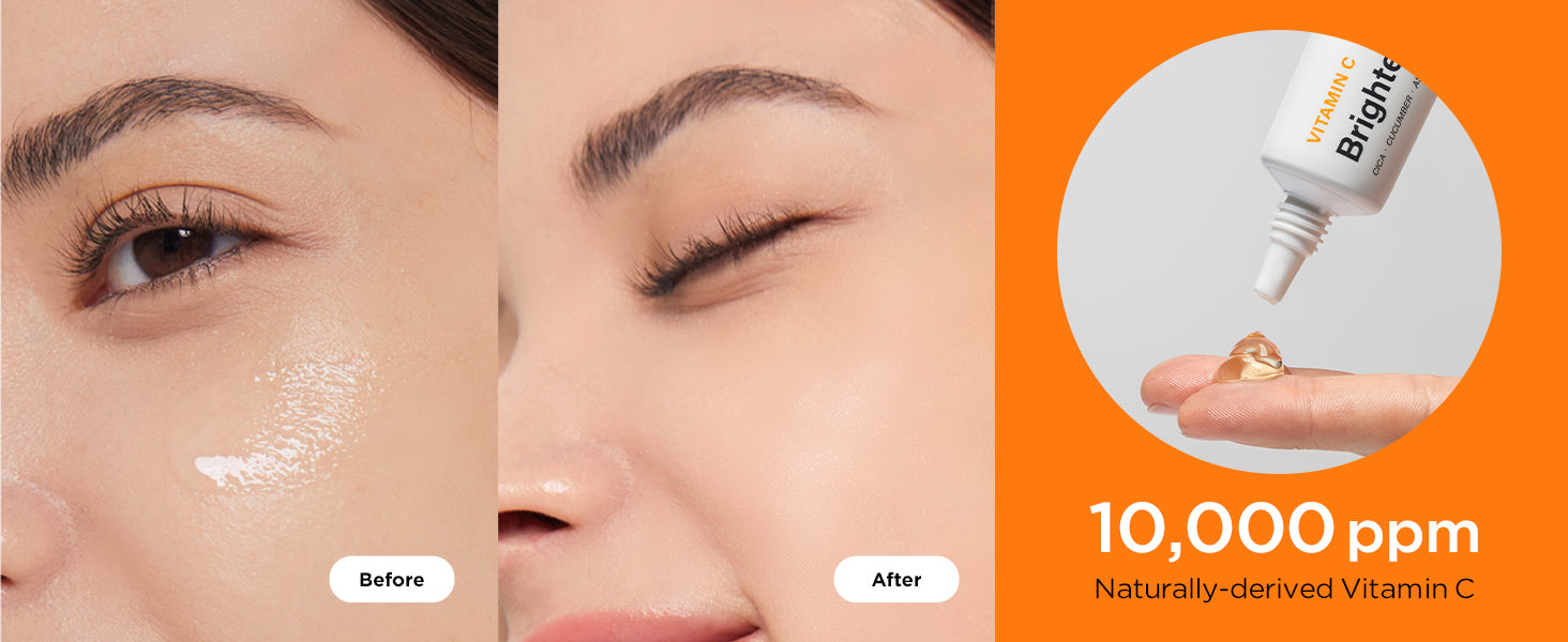 Comparison of skin appearance before and after using Avarelle's Vitamin C Brightening Complex Cream with a concentration of 10,000 ppm.