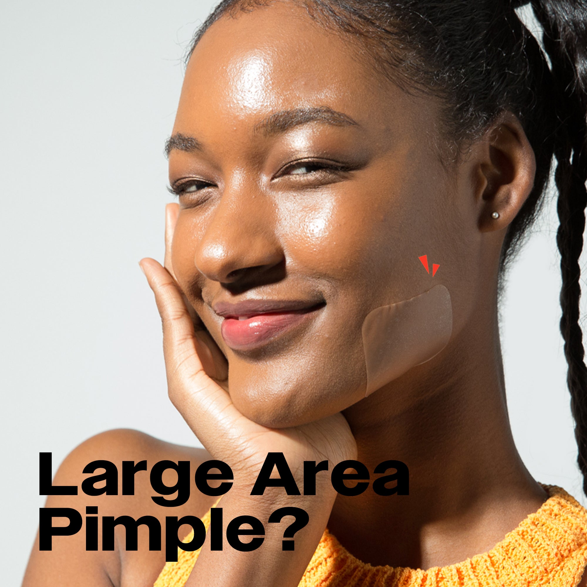 Woman with clear skin aside from a pimple, covered by an Avarelle ZitOut X-Large Patch. Asking Do you have clustered pimples? 